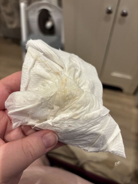 TMI PIC INCLUDED Help! Coloured mucus 7.5 weeks pregnant