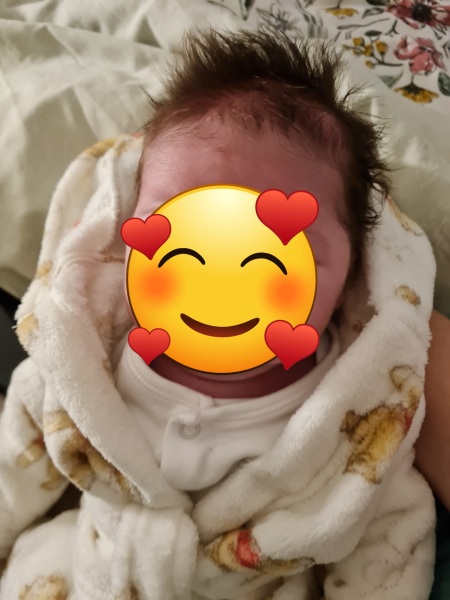 Uncombable hair syndrome or overthinking it??