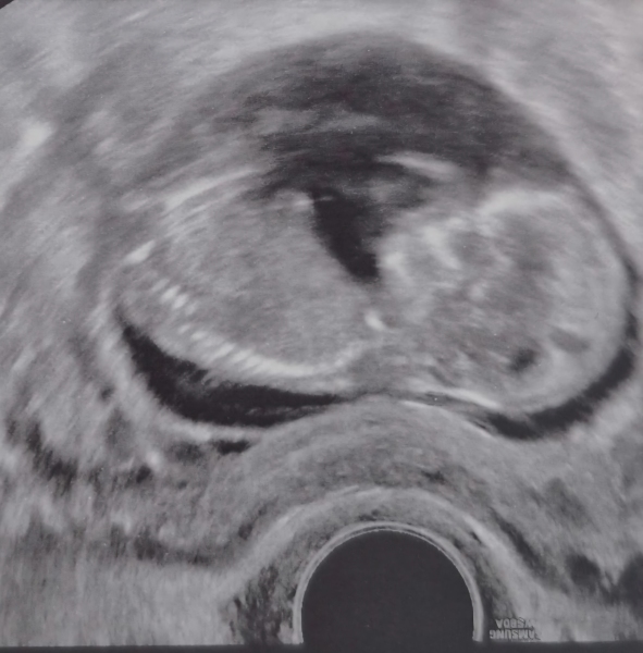 Nub theory gender guesses help please