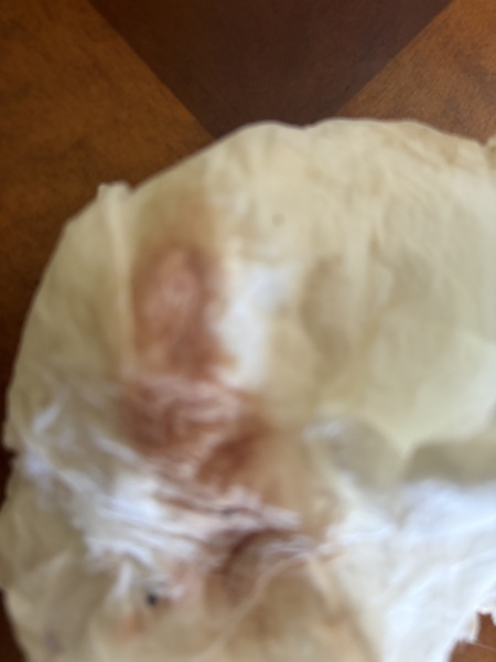Warning pic attached!! Implantation bleeding?
