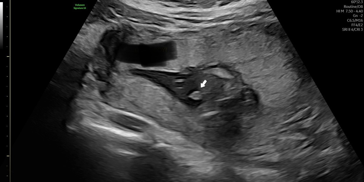 Is baby 💗 or 💙?