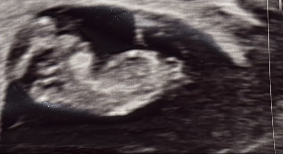 Worried about 11 weeks + 3 scam