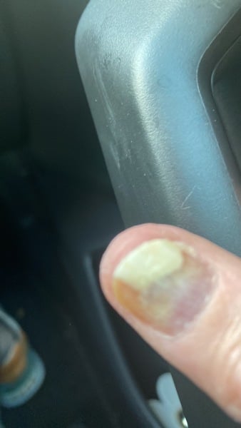 11 year old has done her own nails with UV lamp