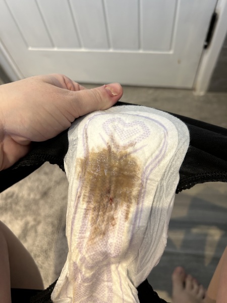 Is this green discharge 2 weeks post partum