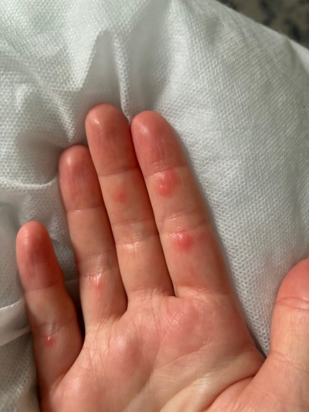 Help! What are these lumps??