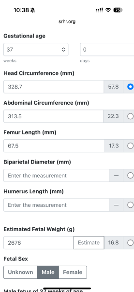 Terrified 20 week scan and short femurs
