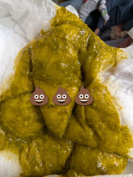Green mucus nappies?! TW: nappy picture
