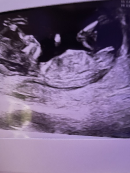 Has anyone been told the gender at 12 week scan?