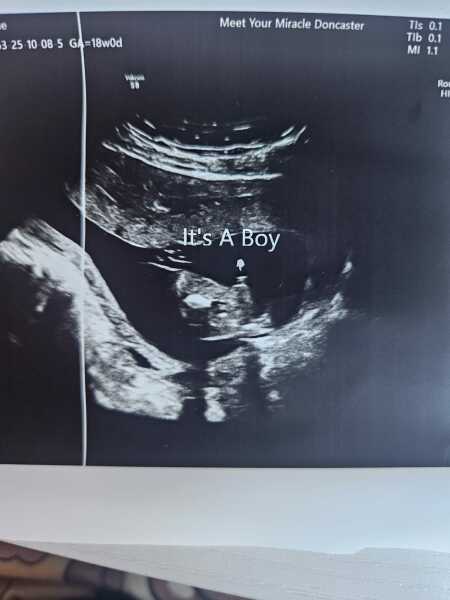 Help understanding gender scan please?