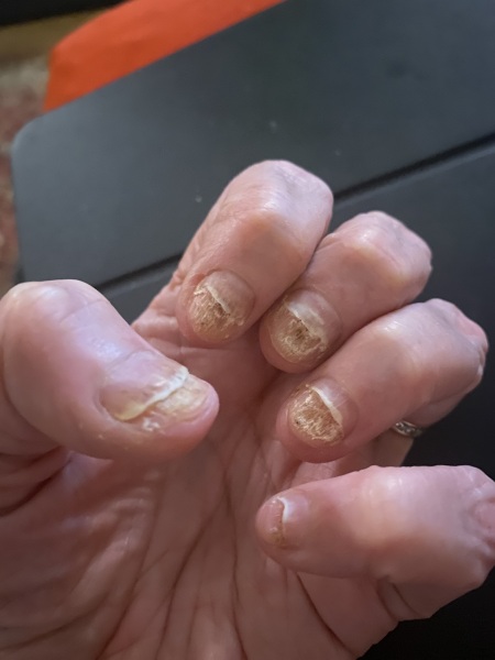 11 year old has done her own nails with UV lamp