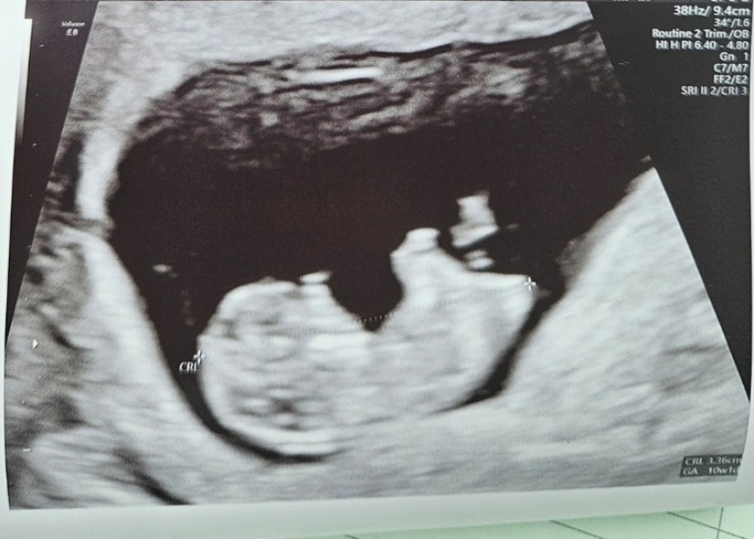 At least we avoided Christmas babies!