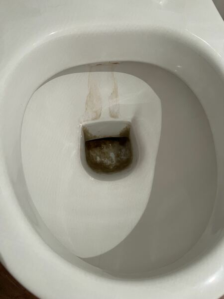 Stained Toilet!