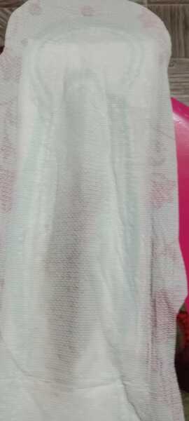 Implantation bleed [Content warning: graphic image]