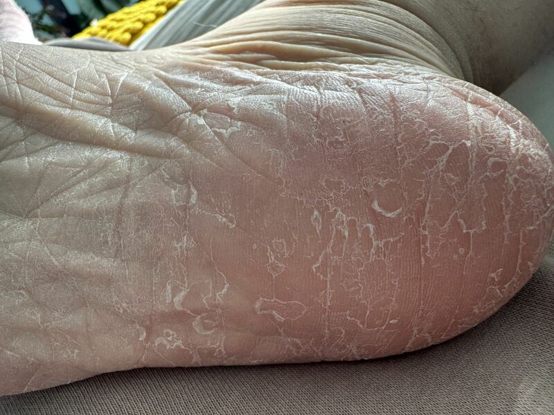 Dry foot