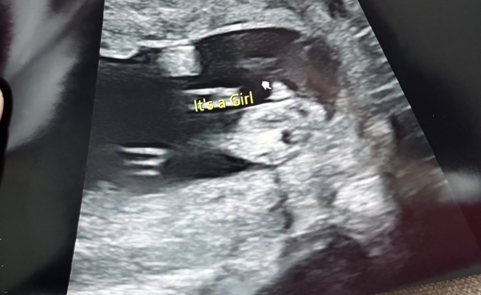 Definitely a baby girl? 💓