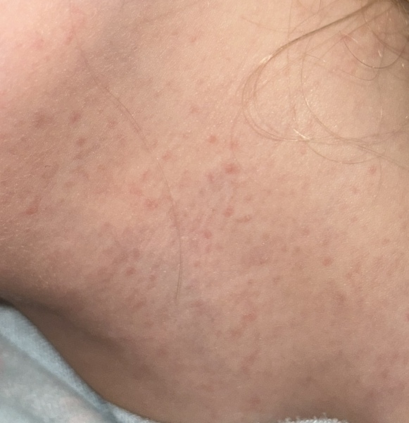 Anyone up? Does this look like just a viral rash??