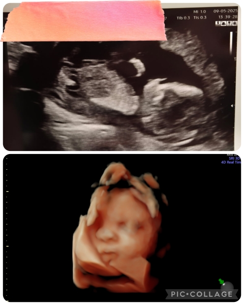 Does this scan look normal?