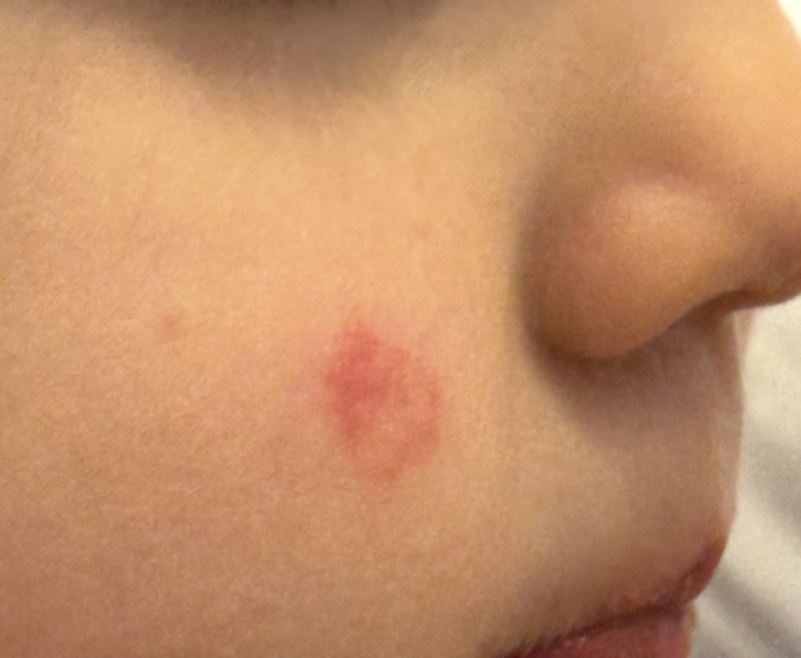 Any ideas on this rash?