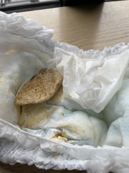 12 month old - Poop colour