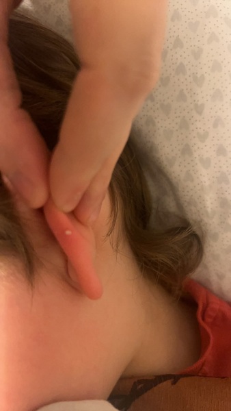 White spot on ear?