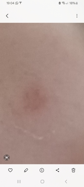 Should I be concerned about this?