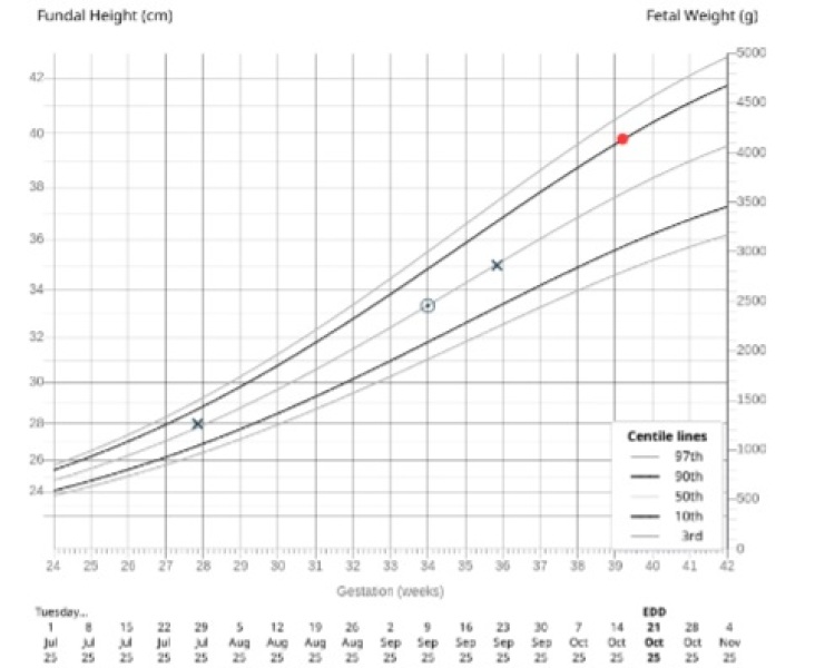 50th to 90th percentile jump in2 weeks