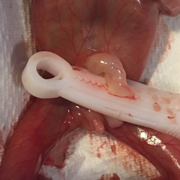 TW *PICTURE IN COMMENTS* 16 week loss gender