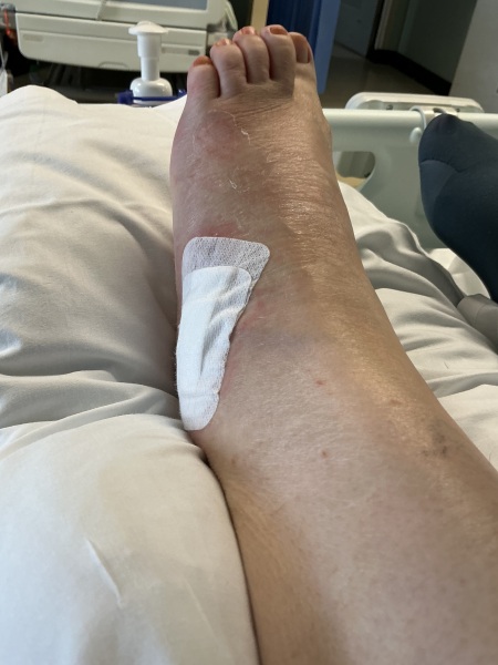 Allison Bailey v Stonewall