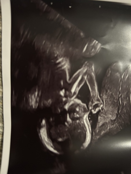Any guesses on gender