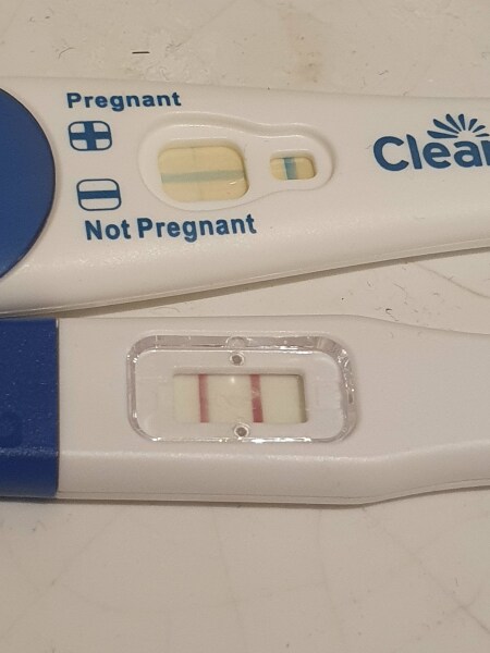 Ectopic pregnancy - how to know detect it early?