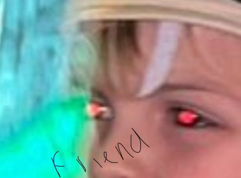 AIBU? Daughter has white eye in flash photo!