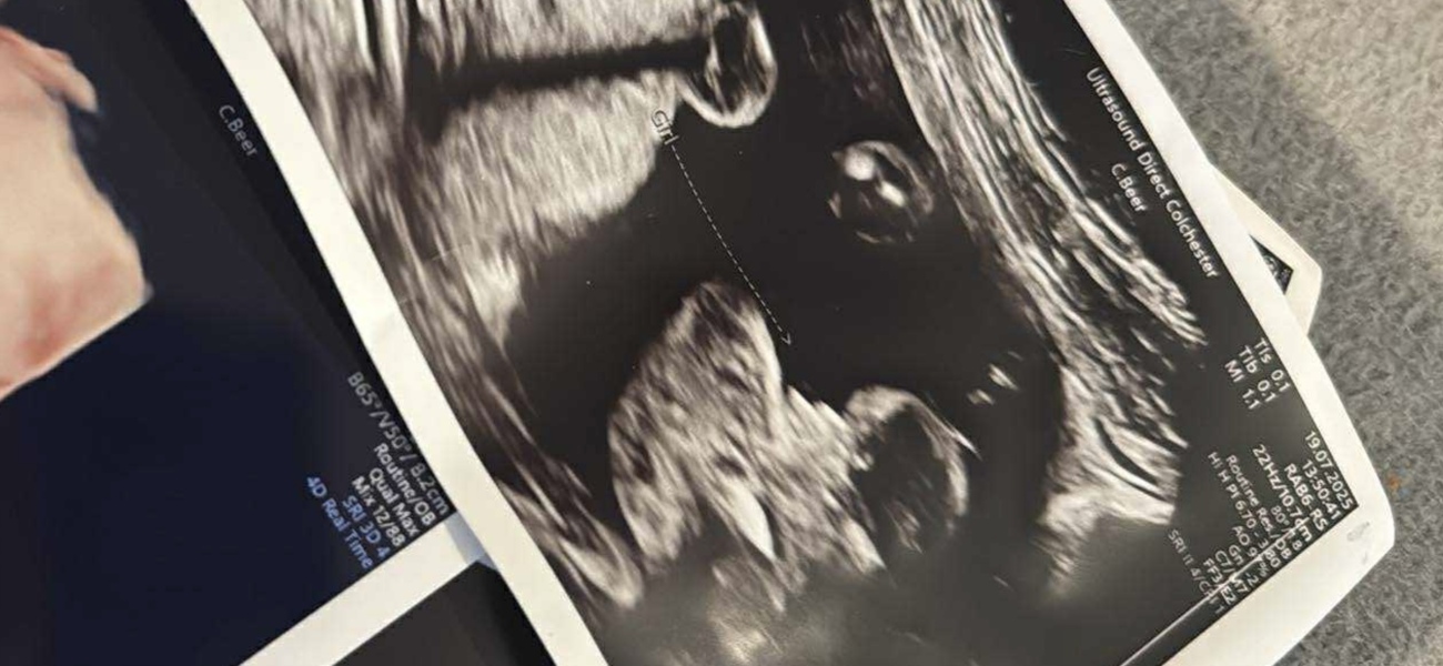 Boy or girl?