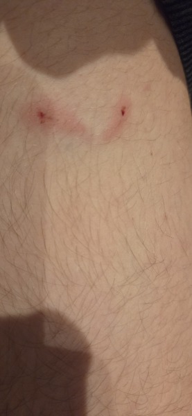 Minor dog bite