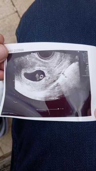 Implantation or miscarriage?