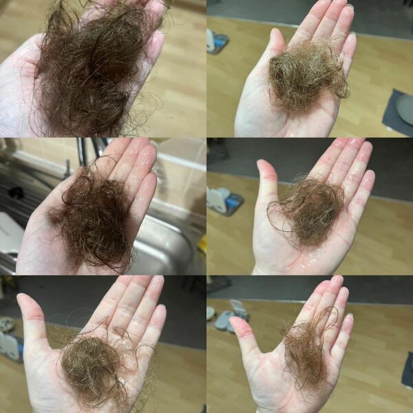 Help me I’m going bald