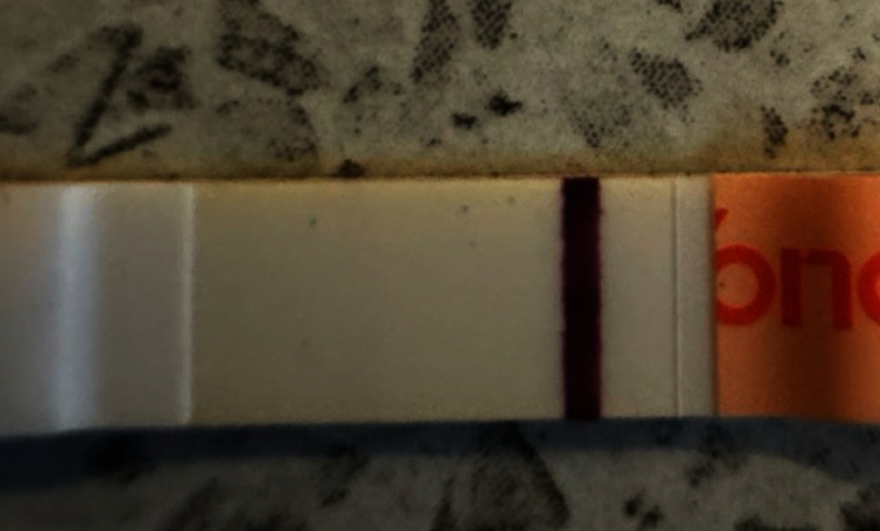 Wondfo vs FRER