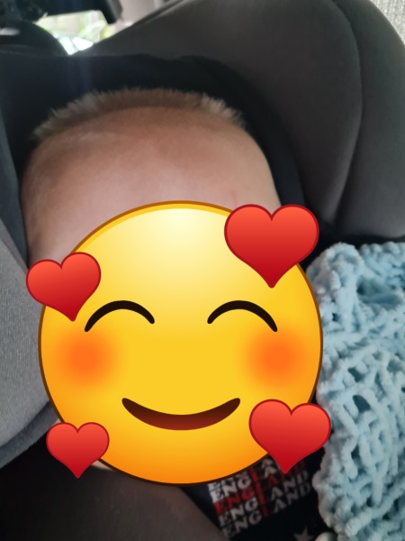 Uncombable hair syndrome or overthinking it??