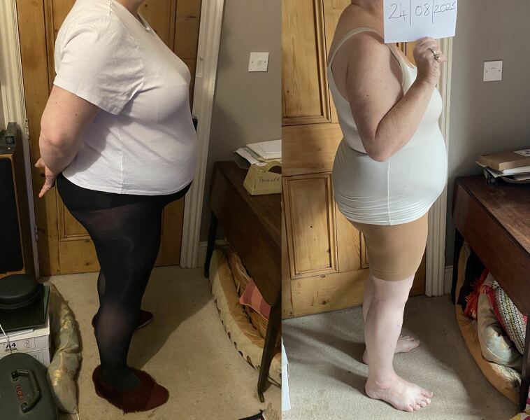 Mounjaro 10st (or more) to lose Thread 8