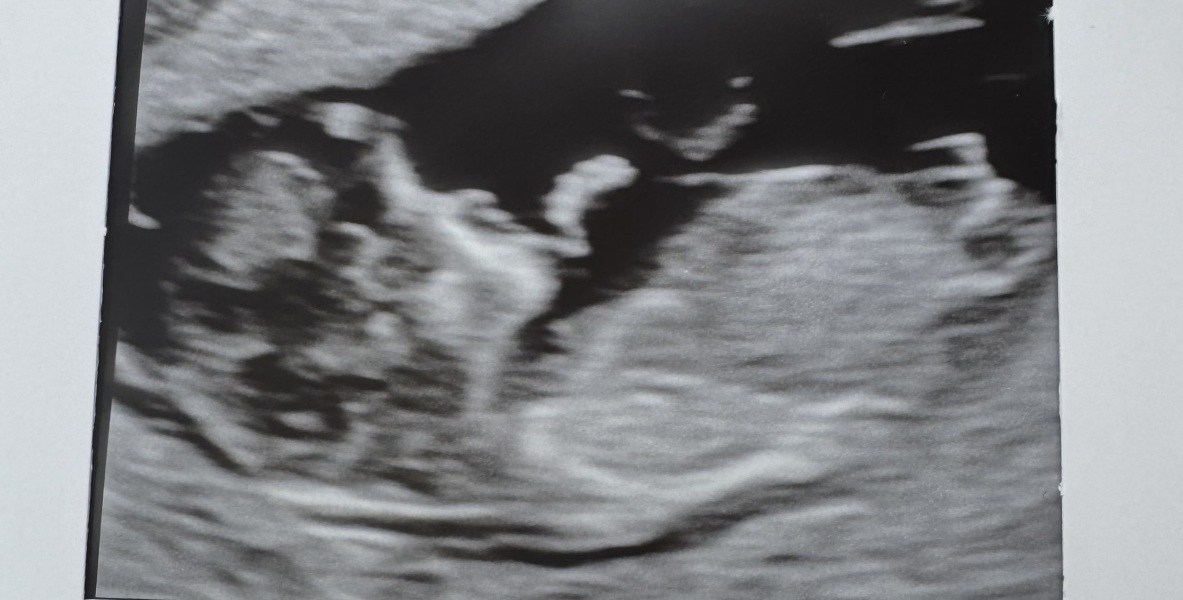 Gender Prediction? Nub Theory!