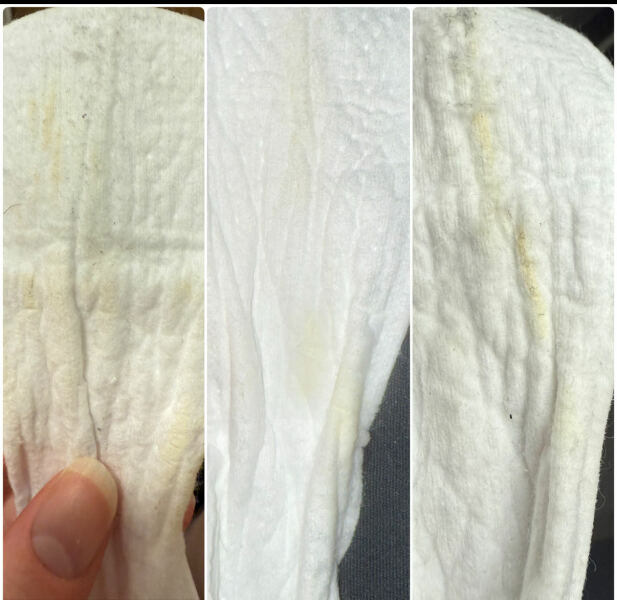 TMI PHOTO INCLUDED. Is this normal pregnancy discharge?