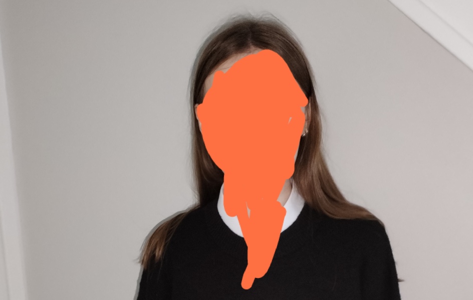 Daughter in hospital - full thickness burns