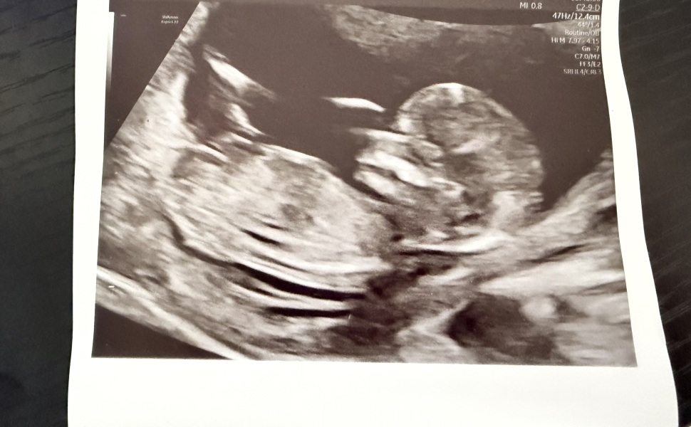 Gender Guesses?