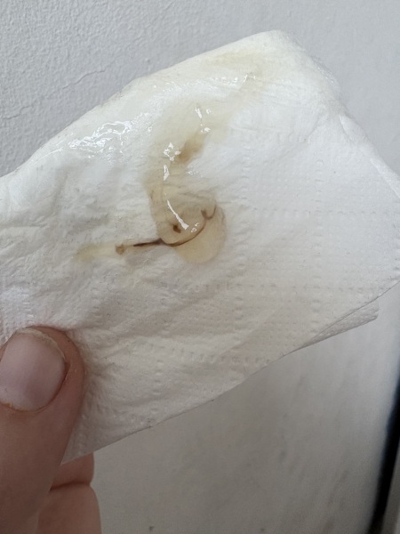 I had this on cd 16 and didn’t have any since but yesterday on cd21 I had lots more [SENSITIVE PHOTO ATTACHED]