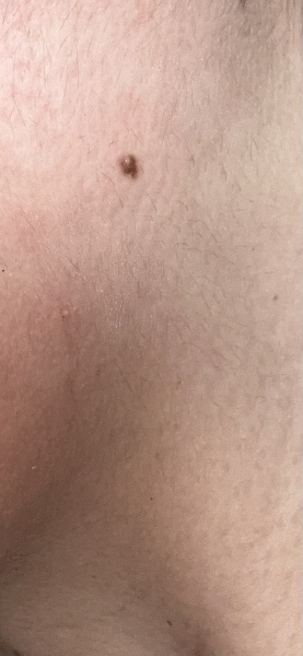 Moles
