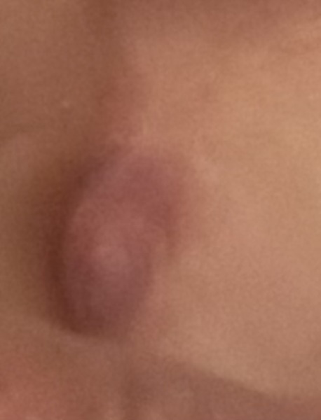 I’m cultivating a third boob, do you want to see it?