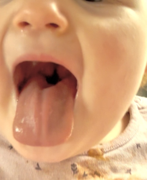 ENT referral for tonsillectomy (18 month old). How long did you wait or did you go private?