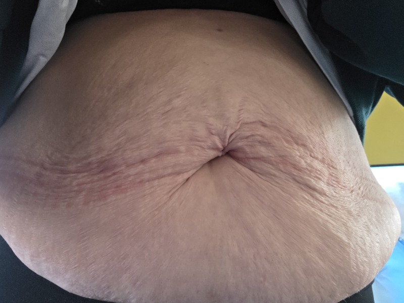 Mounjaro Feb 2025 starters (thread 7!)…