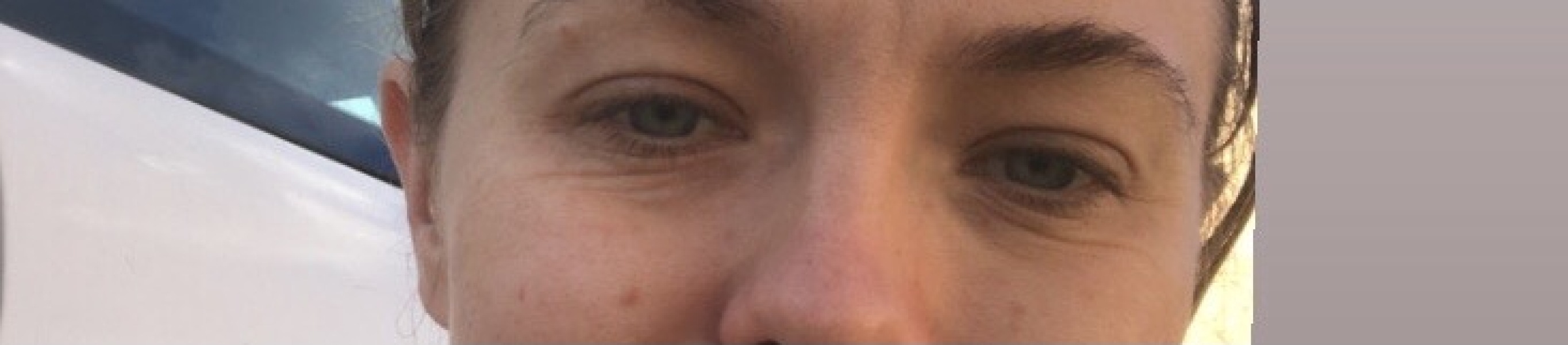 Eye wrinkles