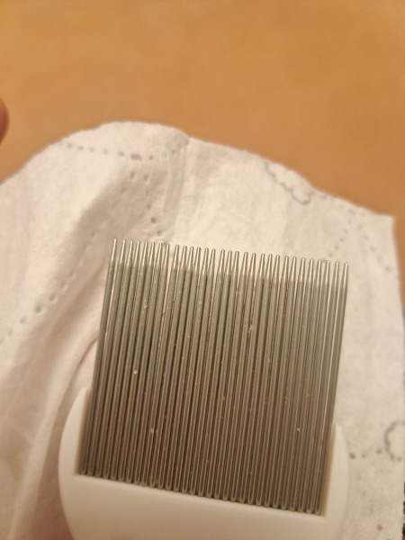 Are these nits? (Sorry, pic attached)