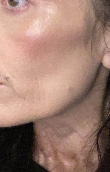 Anyone else stopping due to how aging losing weight is?!